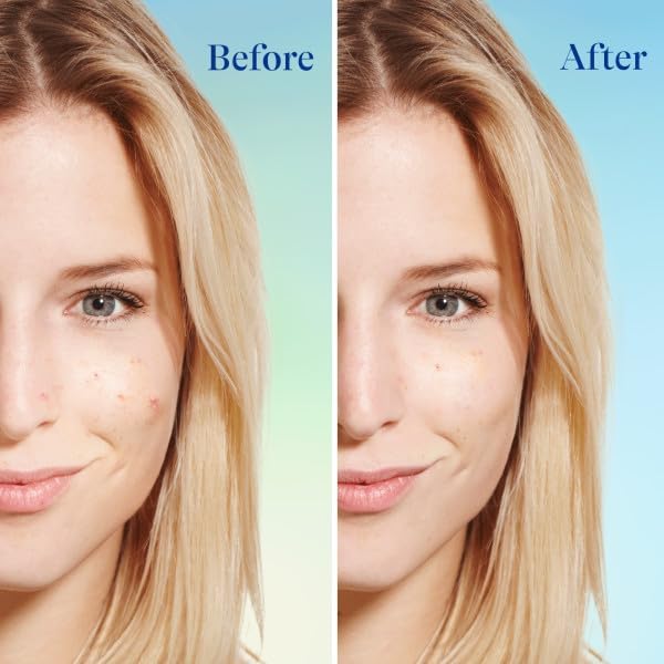 Differin Daily Acne Face Wash Cleanser with Benzoyl Peroxide