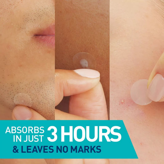 CeraVe Acne Control Patches 22 ct image 2