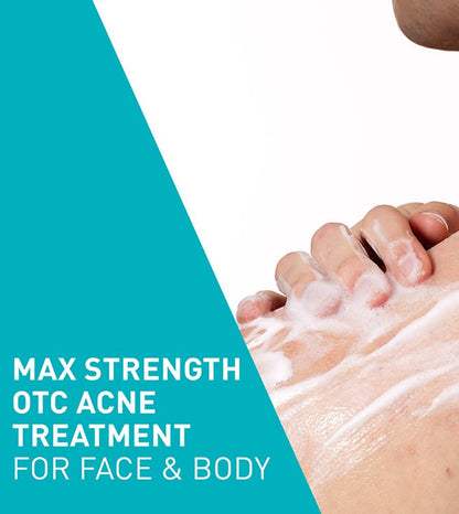 CeraVe Acne Foaming Cream Cleanser 4%