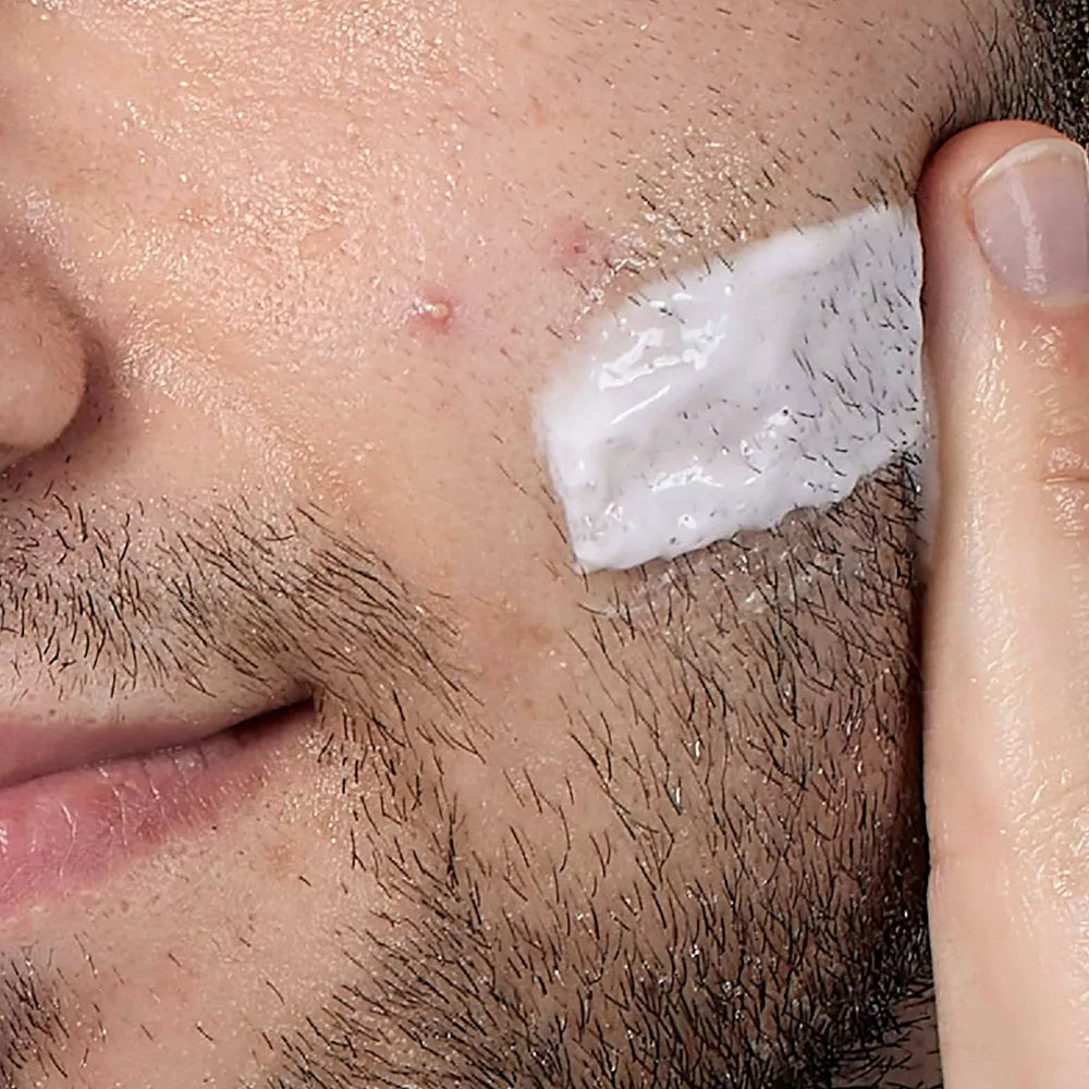 CeraVe Acne Foaming Cream Cleanser BPO 10%