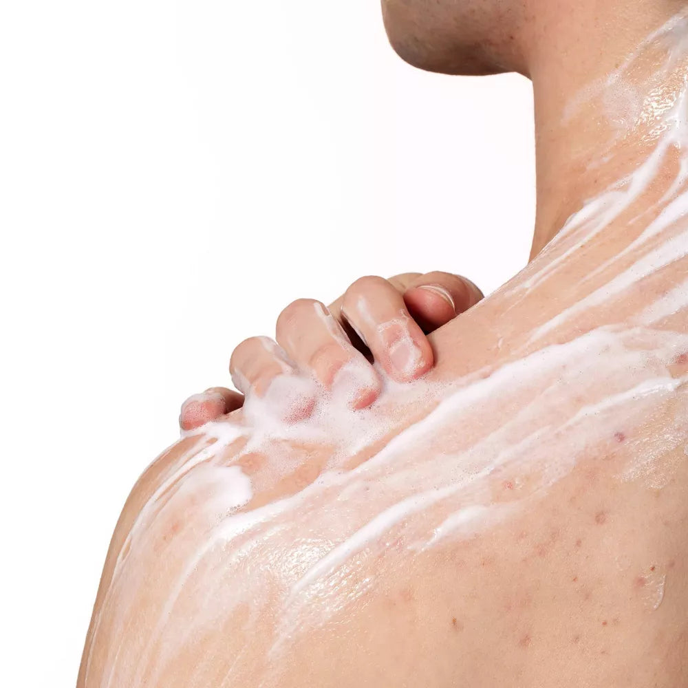 CeraVe Acne Foaming Cream Cleanser BPO 10%