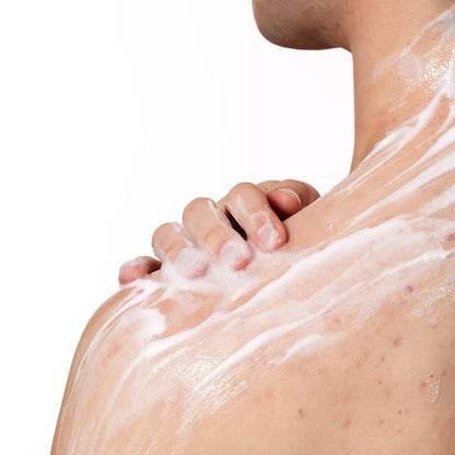 CeraVe Acne Foaming Cream Cleanser BPO 10%