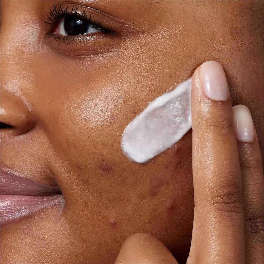 CeraVe Acne Foaming Cream Cleanser BPO 10%