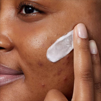 CeraVe Acne Foaming Cream Cleanser BPO 10%