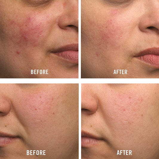 FAB Ultra Repair Cream - 1.0 oz (28.3 g) .