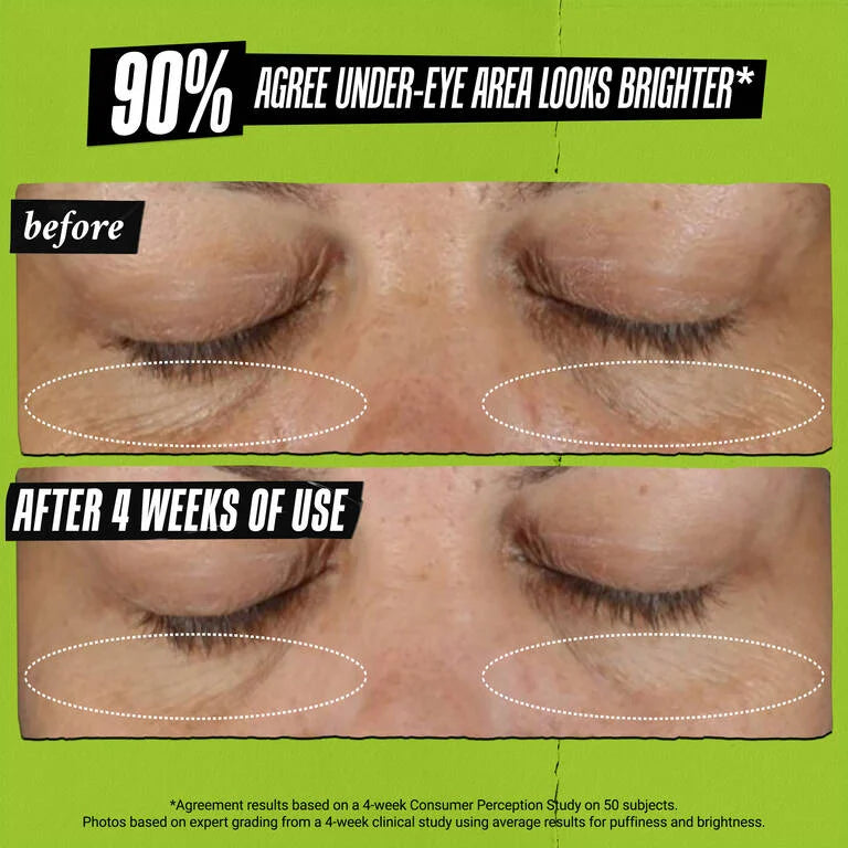 Kiehl’s Creamy Eye Treatment with Avocado|14G