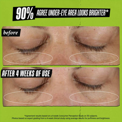 Kiehl’s Creamy Eye Treatment with Avocado|14G